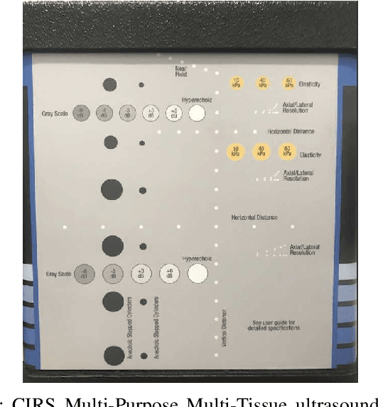Figure 2 for Ultrasound segmentation using U-Net: learning from simulated data and testing on real data