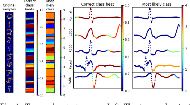 Figure 1 for Techniques for visualizing LSTMs applied to electrocardiograms