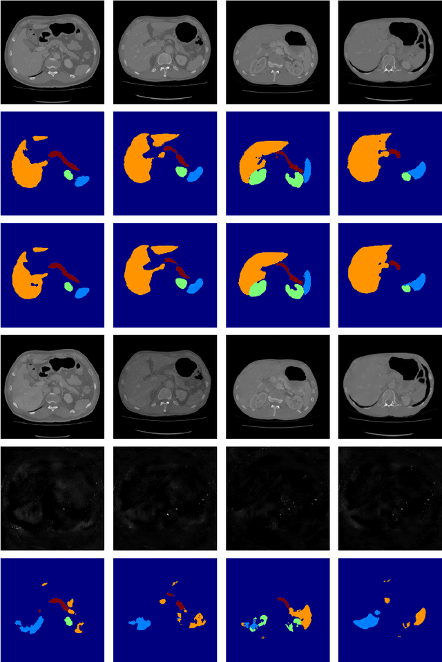 Figure 4 for Intelligent image synthesis to attack a segmentation CNN using adversarial learning
