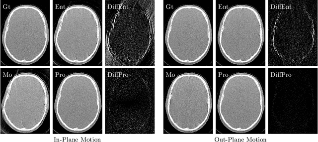 Figure 4 for Deep autofocus with cone-beam CT consistency constraint