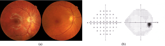 Figure 1 for A Parametric Perceptual Deficit Modeling and Diagnostics Framework for Retina Damage using Mixed Reality