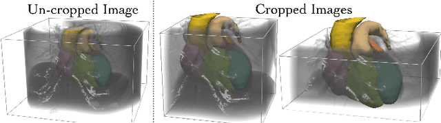 Figure 4 for Learning Whole Heart Mesh Generation From Patient Images For Computational Simulations
