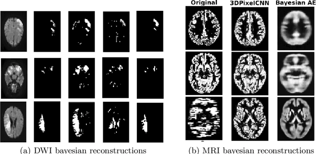Figure 2 for Bayesian Volumetric Autoregressive generative models for better semisupervised learning