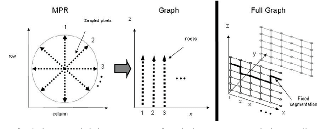 Figure 4 for Aorta Segmentation for Stent Simulation