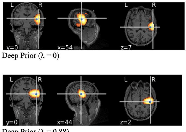 Figure 3 for Current Source Localization Using Deep Prior with Depth Weighting