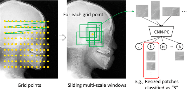 Figure 4 for Deep Learning based Cephalometric Landmark Identification using Landmark-dependent Multi-scale Patches