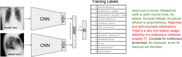 Figure 1 for TextRay: Mining Clinical Reports to Gain a Broad Understanding of Chest X-rays