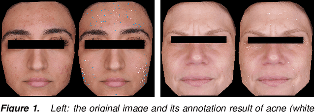Figure 1 for Automatic Facial Skin Feature Detection for Everyone
