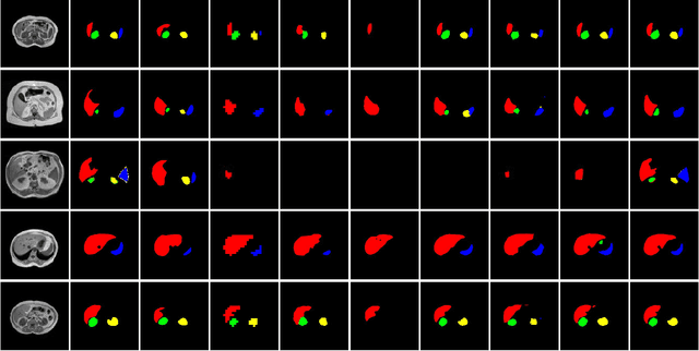 Figure 4 for A New Multiple Max-pooling Integration Module and Cross Multiscale Deconvolution Network Based on Image Semantic Segmentation