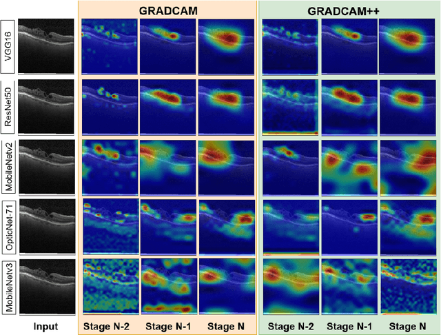 Figure 4 for Feature Representation Learning for Robust Retinal Disease Detection from Optical Coherence Tomography Images