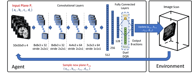 Figure 1 for Automatic View Planning with Multi-scale Deep Reinforcement Learning Agents