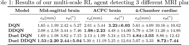 Figure 2 for Automatic View Planning with Multi-scale Deep Reinforcement Learning Agents