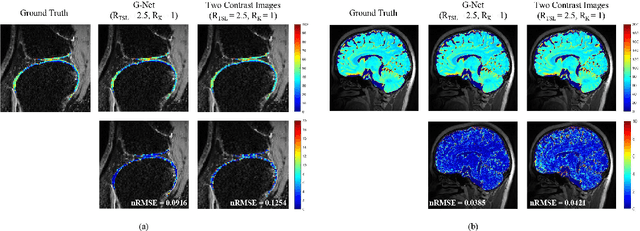 Figure 3 for Highly accelerated MR parametric mapping by undersampling the k-space and reducing the contrast number simultaneously with deep learning