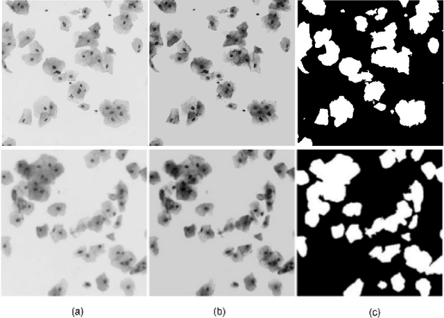 Figure 2 for An Unsupervised Approach for Overlapping Cervical Cell Cytoplasm Segmentation