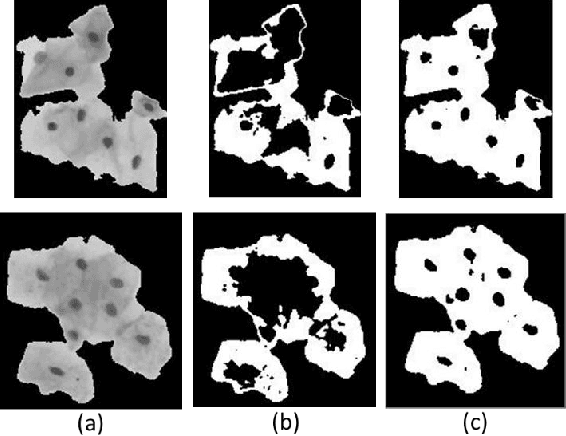 Figure 3 for An Unsupervised Approach for Overlapping Cervical Cell Cytoplasm Segmentation