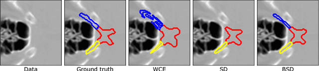 Figure 1 for Segmentation of Head and Neck Organs at Risk Using CNN with Batch Dice Loss