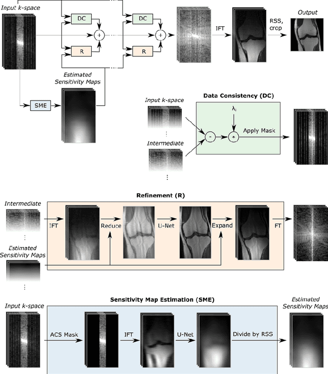 Figure 1 for End-to-End Variational Networks for Accelerated MRI Reconstruction