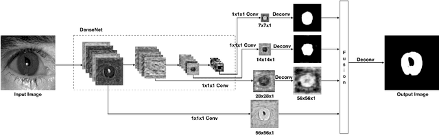 Figure 2 for SegDenseNet: Iris Segmentation for Pre and Post Cataract Surgery