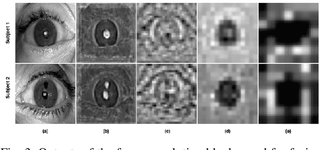 Figure 3 for SegDenseNet: Iris Segmentation for Pre and Post Cataract Surgery
