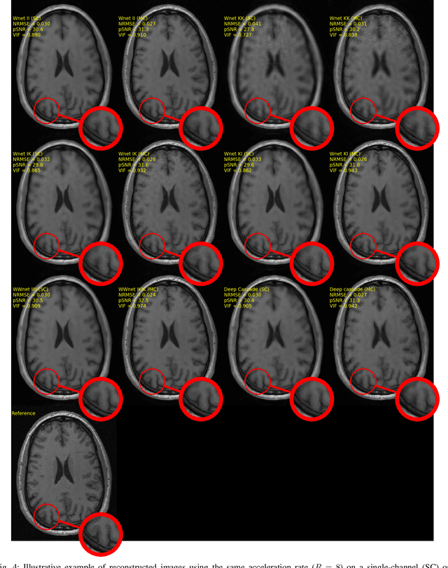 Figure 4 for Dual-domain Cascade of U-nets for Multi-channel Magnetic Resonance Image Reconstruction