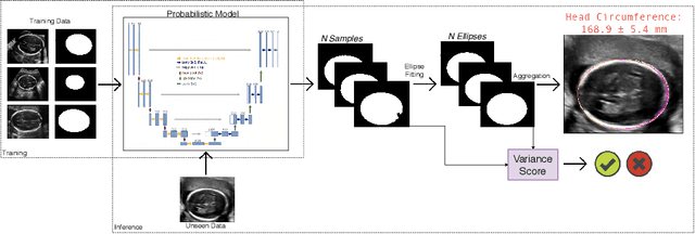 Figure 1 for Confident Head Circumference Measurement from Ultrasound with Real-time Feedback for Sonographers