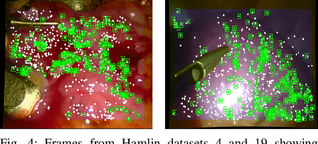 Figure 4 for SD-DefSLAM: Semi-Direct Monocular SLAM for Deformable and Intracorporeal Scenes