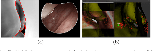 Figure 1 for Anatomically Constrained Video-CT Registration via the V-IMLOP Algorithm