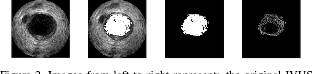 Figure 3 for EREL Selection using Morphological Relation
