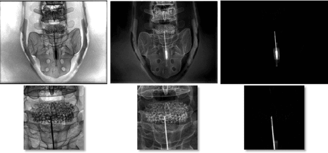 Figure 3 for Precision Learning: Towards Use of Known Operators in Neural Networks