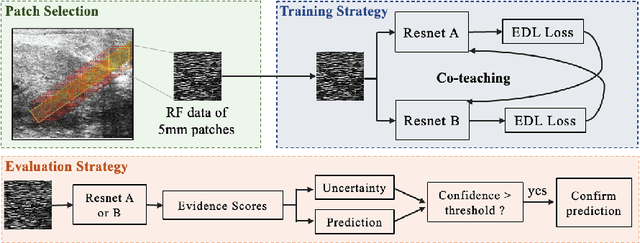 Figure 1 for Towards Confident Detection of Prostate Cancer using High Resolution Micro-ultrasound