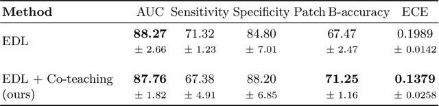 Figure 2 for Towards Confident Detection of Prostate Cancer using High Resolution Micro-ultrasound