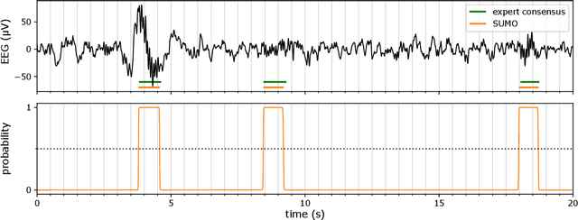 Figure 3 for SUMO: Advanced sleep spindle identification with neural networks