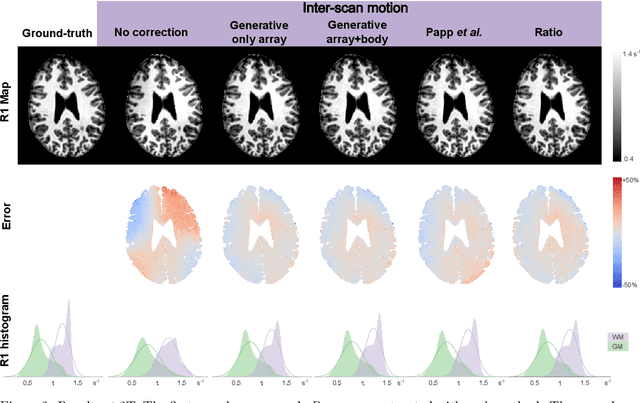 Figure 3 for Correcting inter-scan motion artefacts in quantitative R1 mapping at 7T
