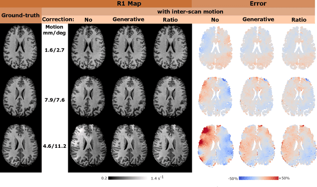 Figure 4 for Correcting inter-scan motion artefacts in quantitative R1 mapping at 7T