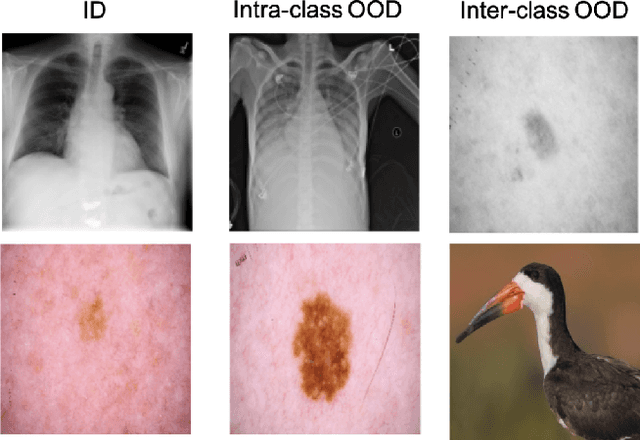 Figure 1 for CVAD: A generic medical anomaly detector based on Cascade VAE