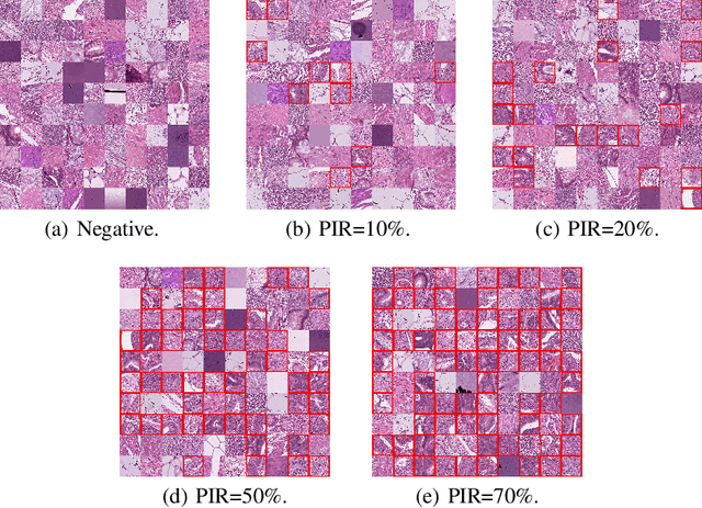 Figure 4 for Bi-directional Weakly Supervised Knowledge Distillation for Whole Slide Image Classification
