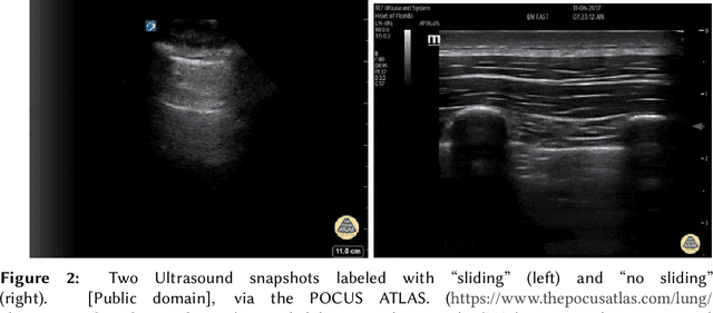 Figure 3 for Do it Like the Doctor: How We Can Design a Model That Uses Domain Knowledge to Diagnose Pneumothorax