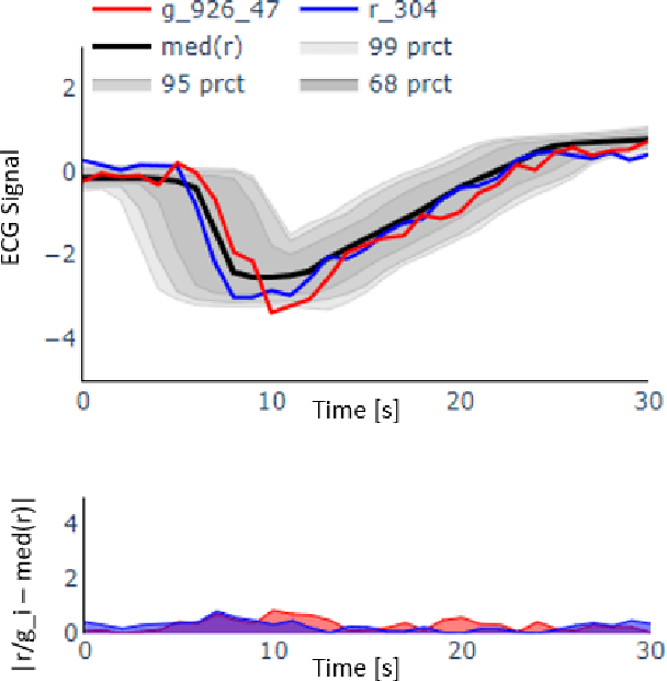 Figure 4 for Visual Evaluation of Generative Adversarial Networks for Time Series Data