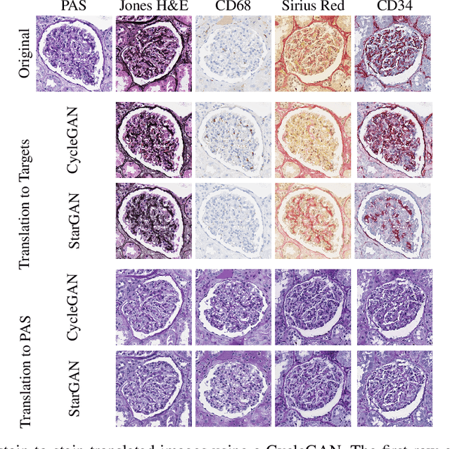 Figure 1 for Towards Histopathological Stain Invariance by Unsupervised Domain Augmentation using Generative Adversarial Networks
