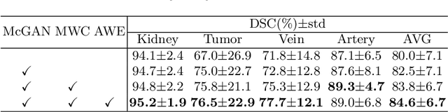 Figure 4 for EnMcGAN: Adversarial Ensemble Learning for 3D Complete Renal Structures Segmentation