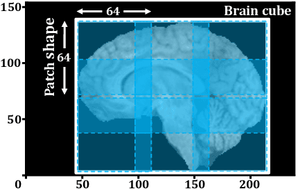Figure 3 for Neural Architecture Search for Gliomas Segmentation on Multimodal Magnetic Resonance Imaging
