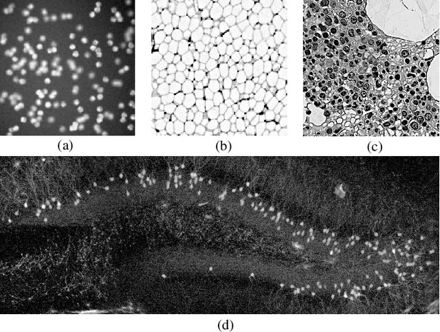 Figure 3 for Enhanced Center Coding for Cell Detection with Convolutional Neural Networks