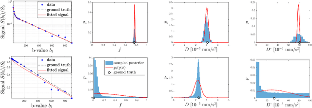 Figure 3 for Implicit Modeling with Uncertainty Estimation for Intravoxel Incoherent Motion Imaging