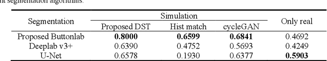 Figure 2 for Defective samples simulation through Neural Style Transfer for automatic surface defect segment