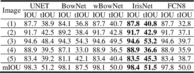 Figure 2 for IrisNet: Deep Learning for Automatic and Real-time Tongue Contour Tracking in Ultrasound Video Data using Peripheral Vision