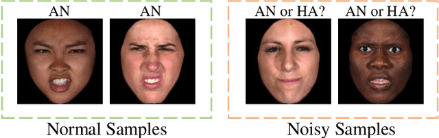 Figure 1 for MFEViT: A Robust Lightweight Transformer-based Network for Multimodal 2D+3D Facial Expression Recognition