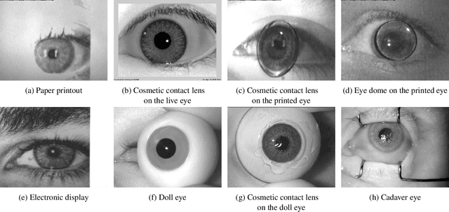 Figure 2 for Iris Liveness Detection Competition (LivDet-Iris) -- The 2020 Edition