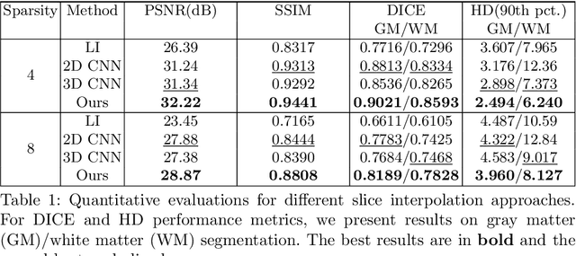 Figure 2 for Deep Slice Interpolation via Marginal Super-Resolution, Fusion and Refinement