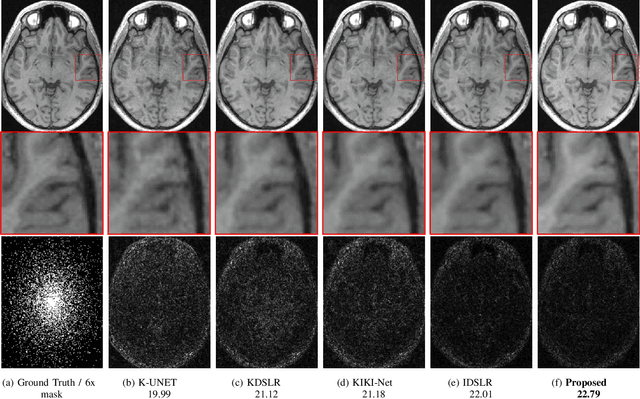 Figure 4 for Joint Calibrationless Reconstruction and Segmentation of Parallel MRI