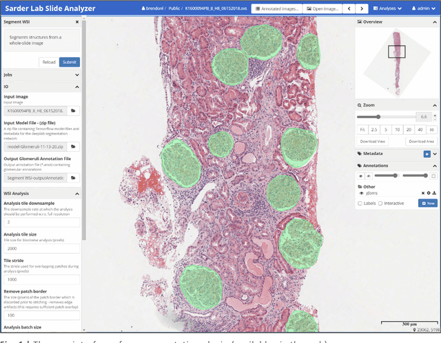 Figure 1 for A tool for user friendly, cloud based, whole slide image segmentation
